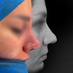 دکتر پنجه طلای بینی اصفهان