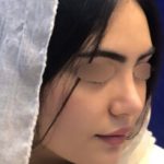 بهترین دکتر عمل بینی فانتزی اصفهان