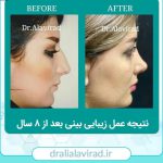 بینی فانتزی