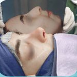 جراح بینی در شاهین شهر