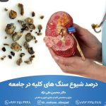 دکتر سنگ شکن کرمان،دکتر سنگ کلیه کرمان