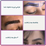 بهترین دکتر کاشت ابرو اصفهان ، نکات کلیدی در مورد هزینه کلینیک ها