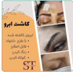 کاشت ابرو اصفهان