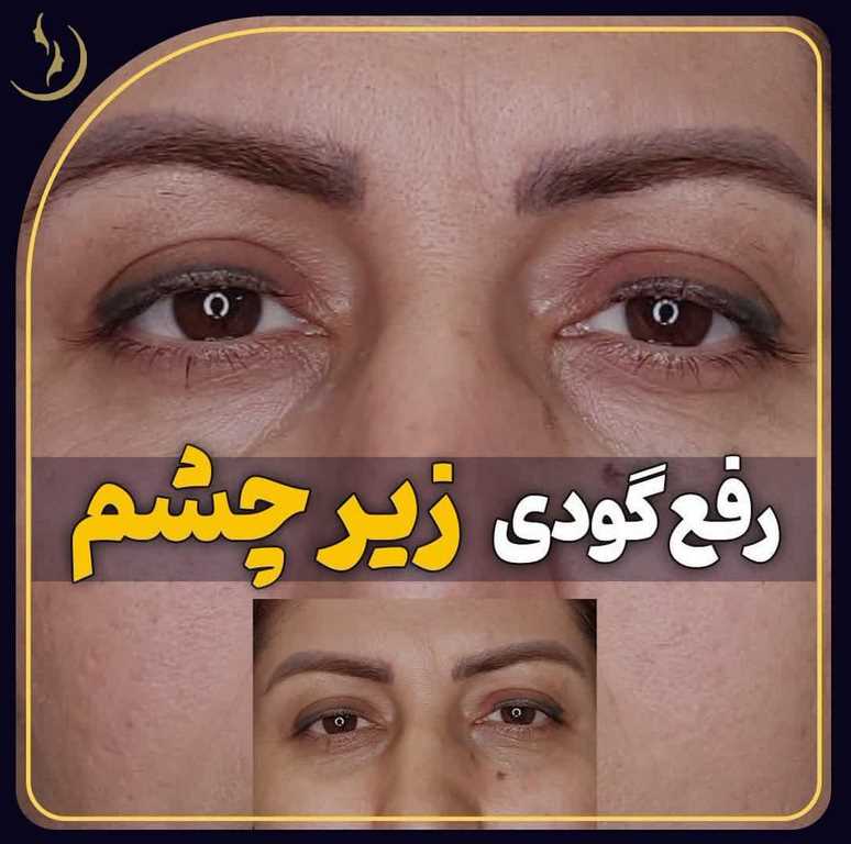 بهترین دکتر متخصص مزو تراپی قم ، دکتر ابوطالبی