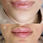 بهترین دکتر بوتاکس اراک