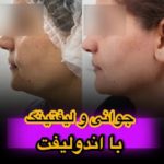 اندولیفت کرمان2