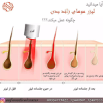 لیست قیمت لیزر شیراز