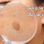 درمان لک صورت کرمان