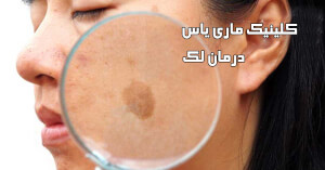 درمان لک صورت کرمان