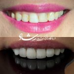 دندانپزشکی طرف قرارداد بیمه اهواز