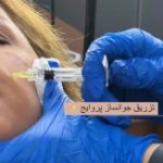 بهترین دکتر مزوتراپی سمنان