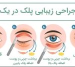 بهترین دکتر عمل زیبایی پلک اصفهان -