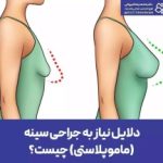 بهترین دکتر پروتز سینه اصفهان -