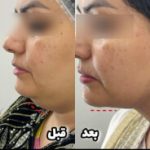 بهترین دکتر رفع غبغب کرمان