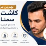 بهترین کاشت مو سمنان