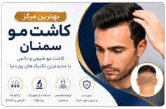 بهترین کاشت مو سمنان