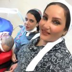 کاشت موی ژاله