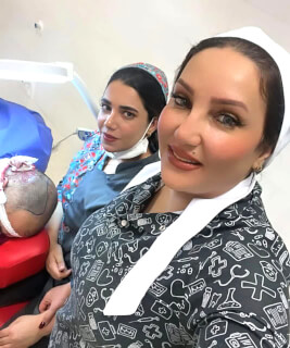 کاشت موی ژاله